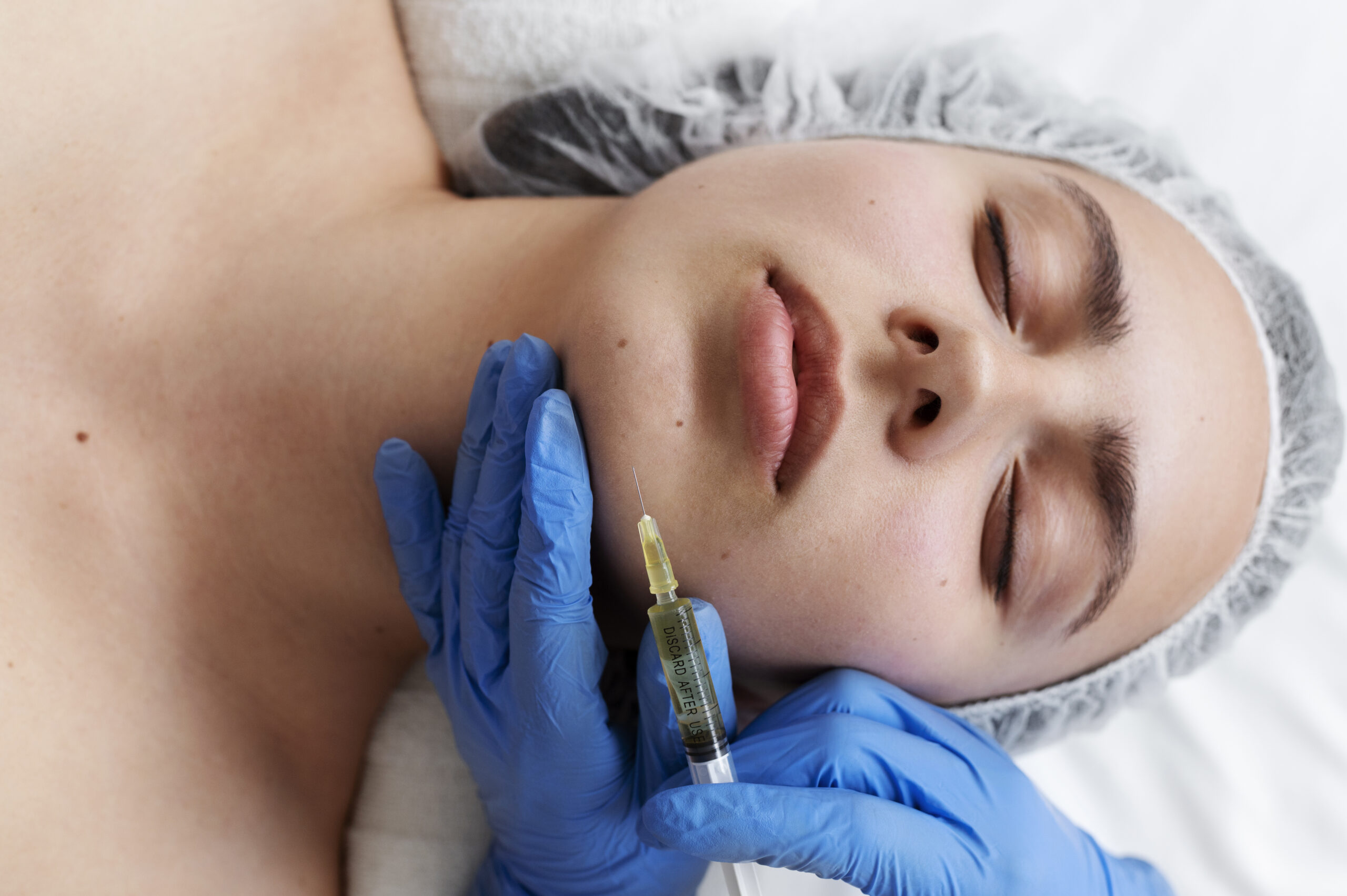 PRP Treatments for Facial