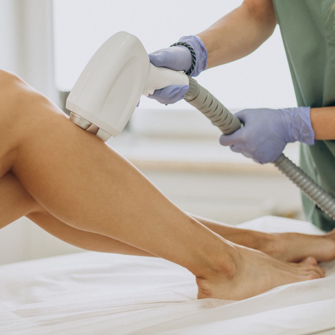 best laser hair removal