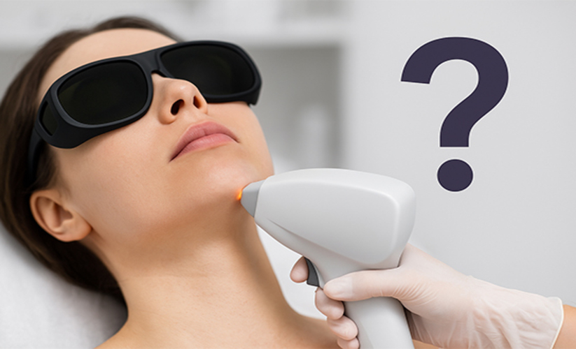 Chin hair removal